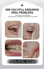 ProBioWhite – Dentifrice Probiotique Hydroxyapatite