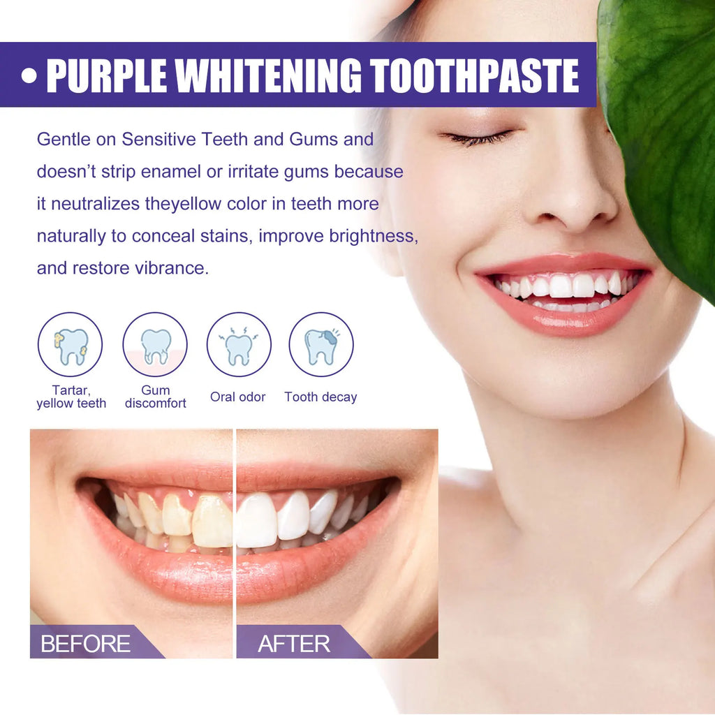 BrightV34 – Dentifrice Blanchissant Instantané