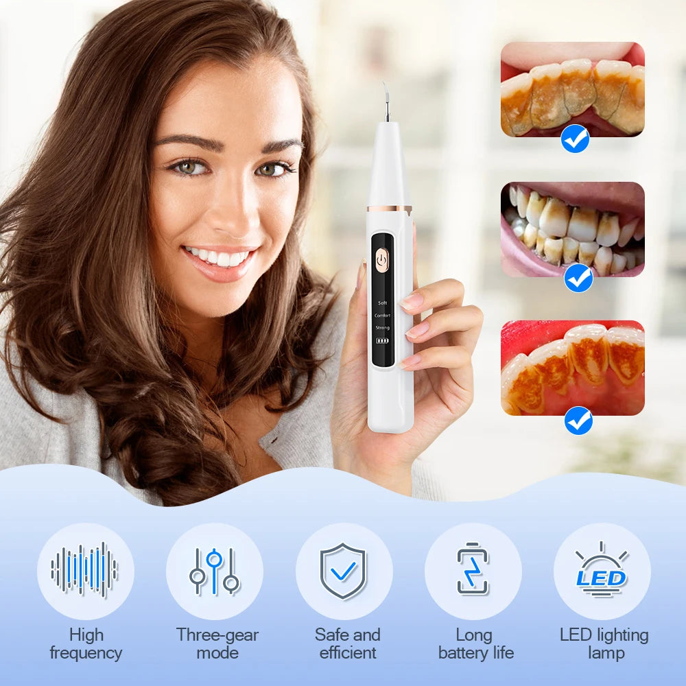 SonicScaler Pro – Détartreur Dentaire Ultrasonique Électrique