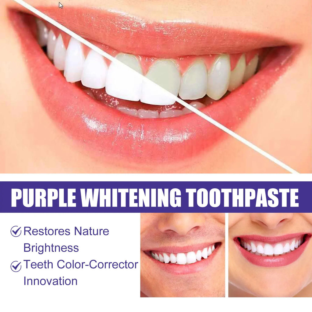 BrightV34 – Dentifrice Blanchissant Instantané