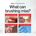 HismileKit – Kit Complet Soins Bucco-Dentaires Hismile
