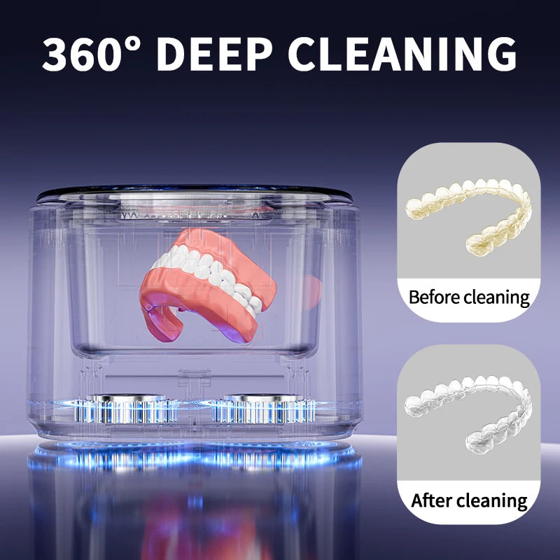ClaryClean 45K – Nettoyeur Ultrasonique pour Gouttières & Prothèses