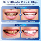SmileRestore – Soin Buccal Restaurateur Oralhoe