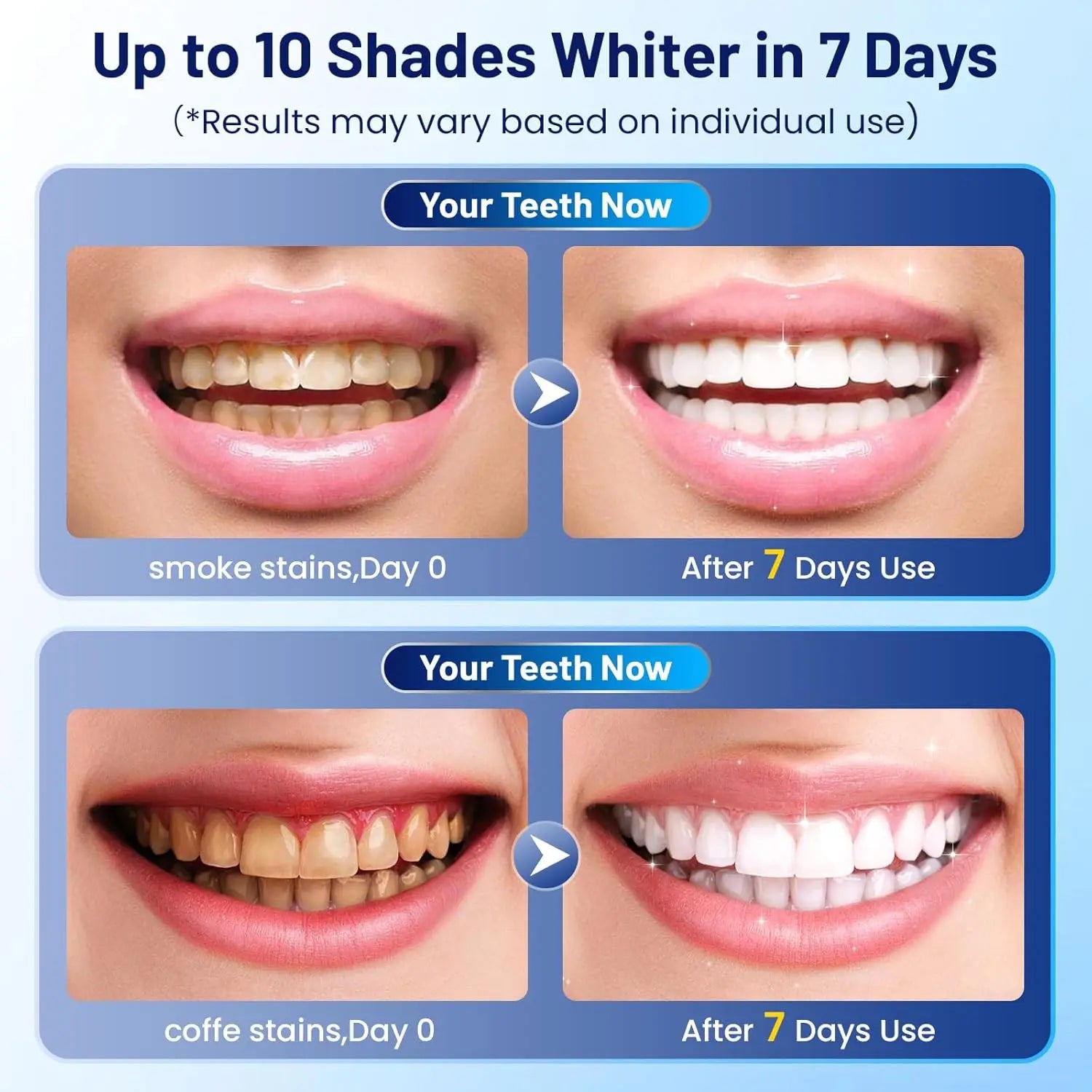 SmileRestore – Soin Buccal Restaurateur Oralhoe